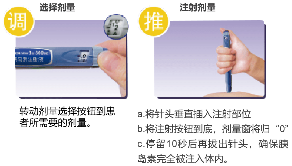 谷赖胰岛素注射流程总 结2017年《中国住院患者血糖管理专家共识》[11