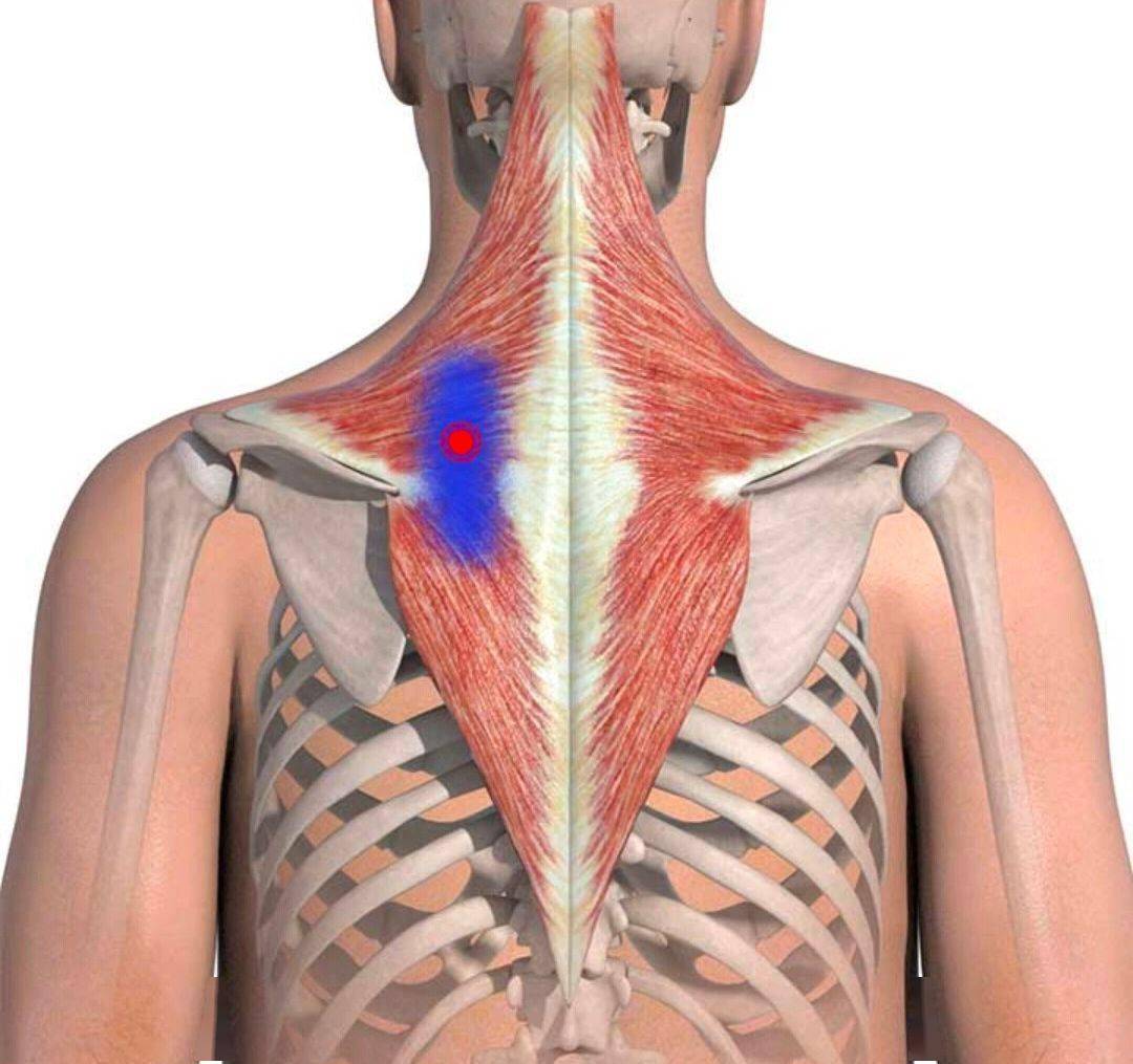 肩頸解剖之斜菱肩提肌和疼痛觸發點