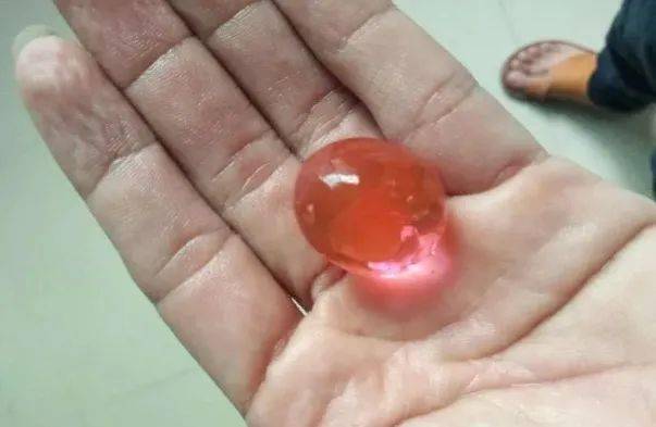 2020年8月12日上午,柳州市柳东新区一名3岁女孩鼻腔里被玩具子弹枪