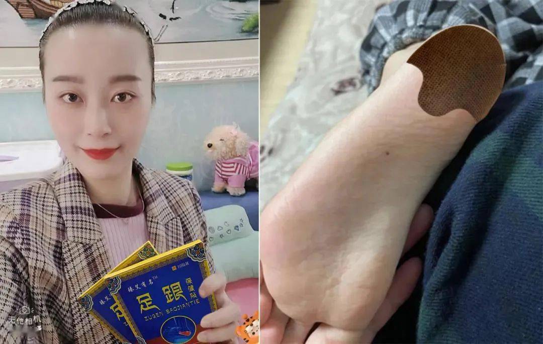 45岁阿姨后悔不已总是脚后跟疼没在意没想到要截肢