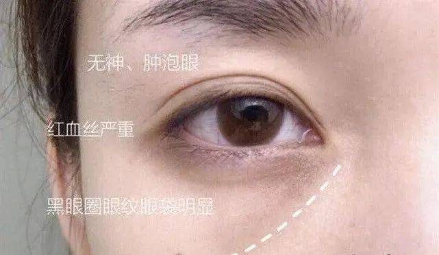 内部测试她眼睛怎么这样？娜B才20岁啊，这也太冤了吧…