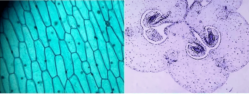 答案是顯微鏡下的洋蔥表面和百合花子房.