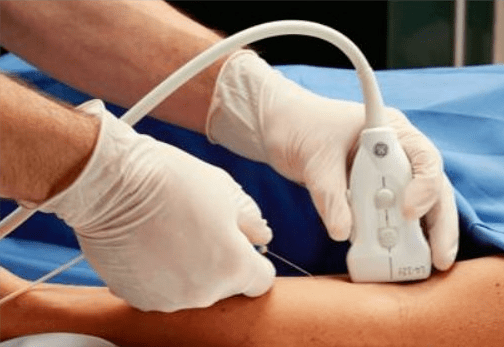 实战技术 | 超声可视化在血管通路建立中的应用_静脉_患者_解剖