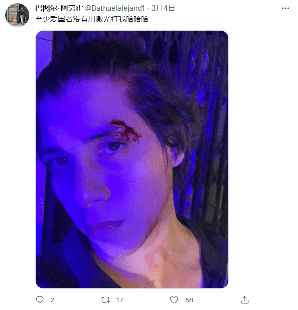 扮演者|用镭射眼加热母乳的超人是屑吗?