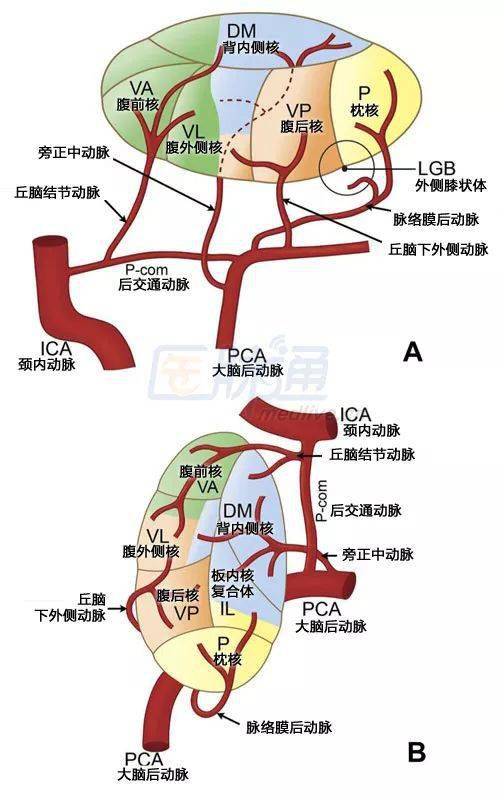 症状|图文并茂：丘脑梗死的临床和影像学特征