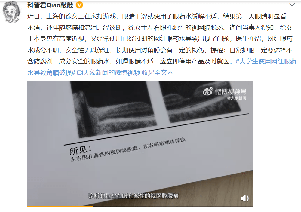 网红眼药水导致视网膜脱落?用眼药水前,一定要知道的事