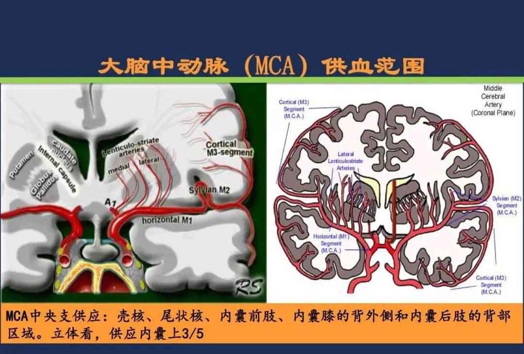 從梗死部位推測責任血管:腦血管解剖_動脈_前型_皮質