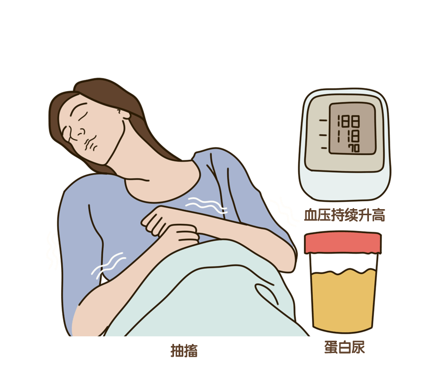 考虑到子痫可能导致胎盘早剥,早产,胎儿死亡,肺水肿,急性肾功能衰竭等