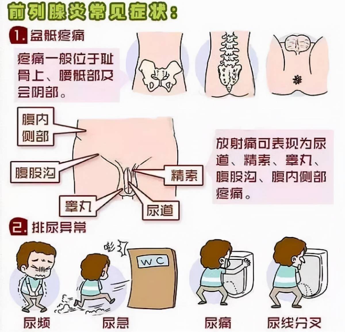 有尿频尿急尿道口滴白是前列腺炎吗一文读懂前列腺液检查