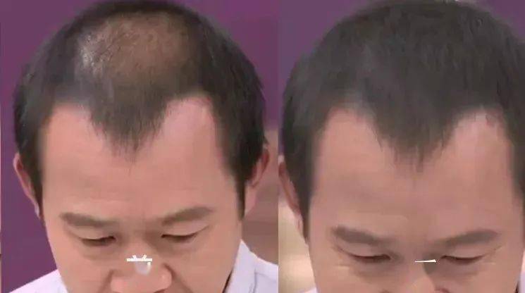 发型DOUBLE UP蓬蓬美发粉饼！防水防汗不易脱！让你瞬间年轻十岁！