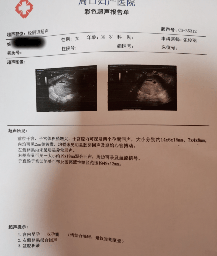 怀孕诊断报告图片