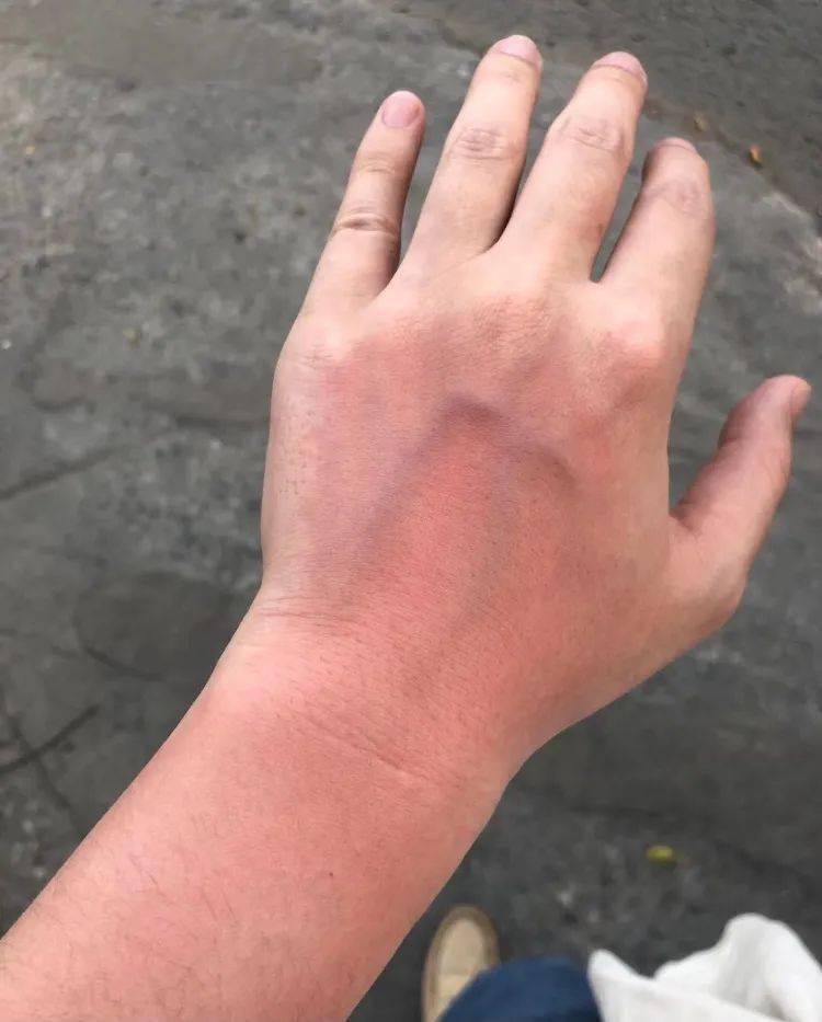 品牌福利购丨接下来三个月不做这件事，你的脸上将会出现可怕的现象…