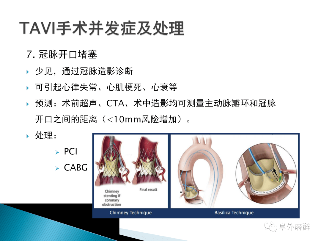 基础知识经导管主动脉瓣植入术tavi麻醉管理及并发症
