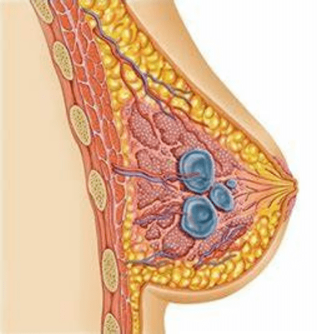 乳腺肿块球形图片