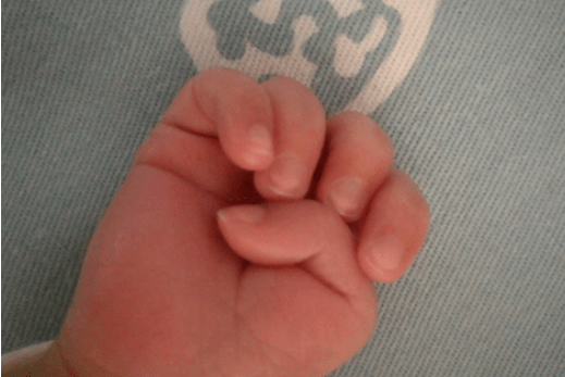 婴儿正确握拳图片图片