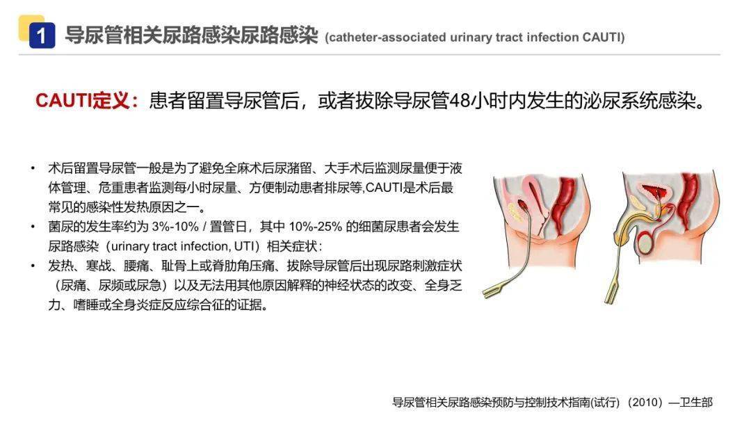 ppt导尿管相关尿路感染护理