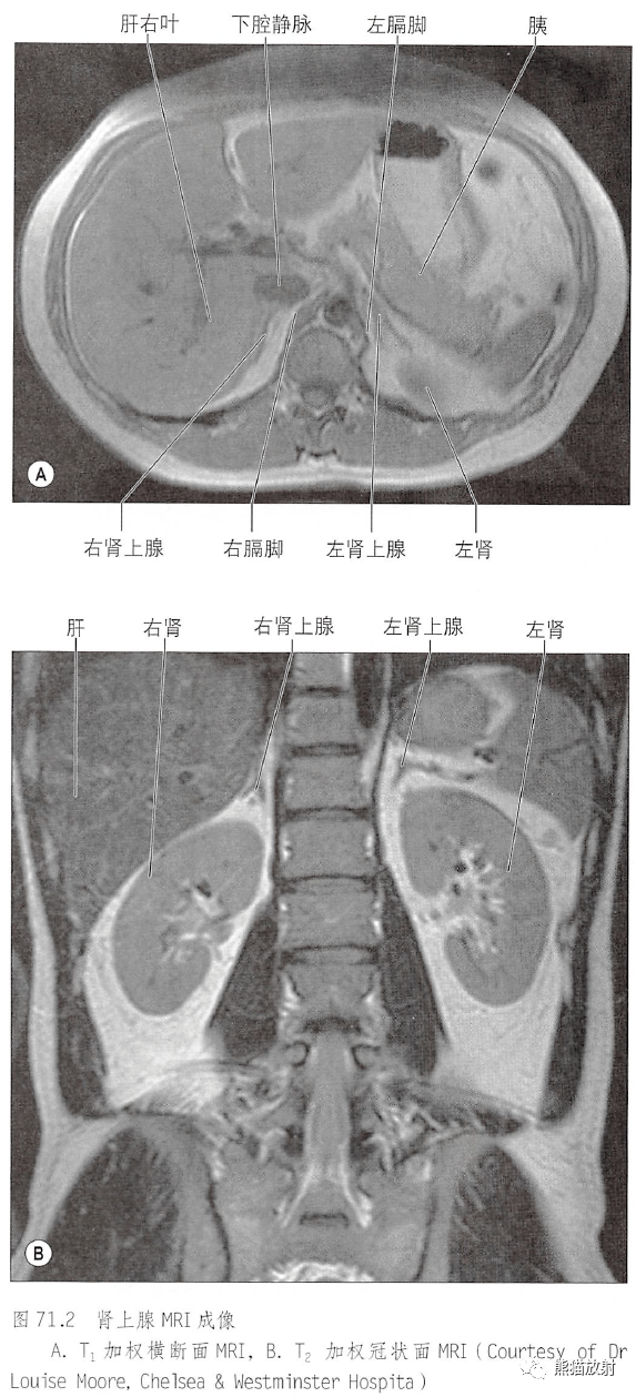 解剖丨脾腎上腺泌尿生殖發育腎和輸尿管