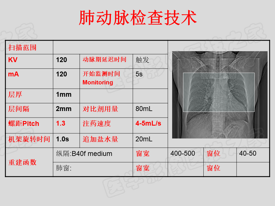 心脏ct正常报告单图片图片