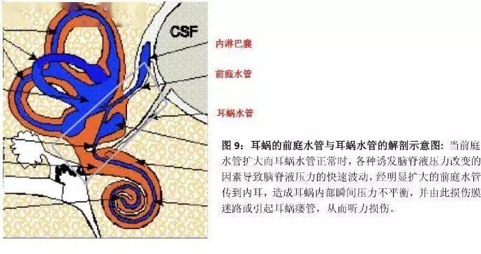 读懂大前庭导水管的解剖及生理