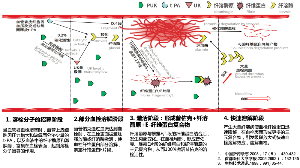 stemi溶栓61经典病例冠脉溶栓普佑克病例分享