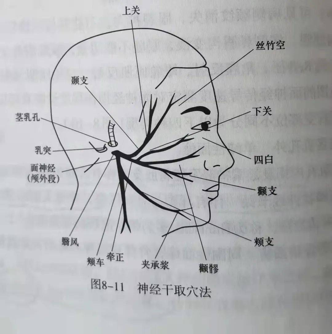 茎乳突孔体表定位图图片