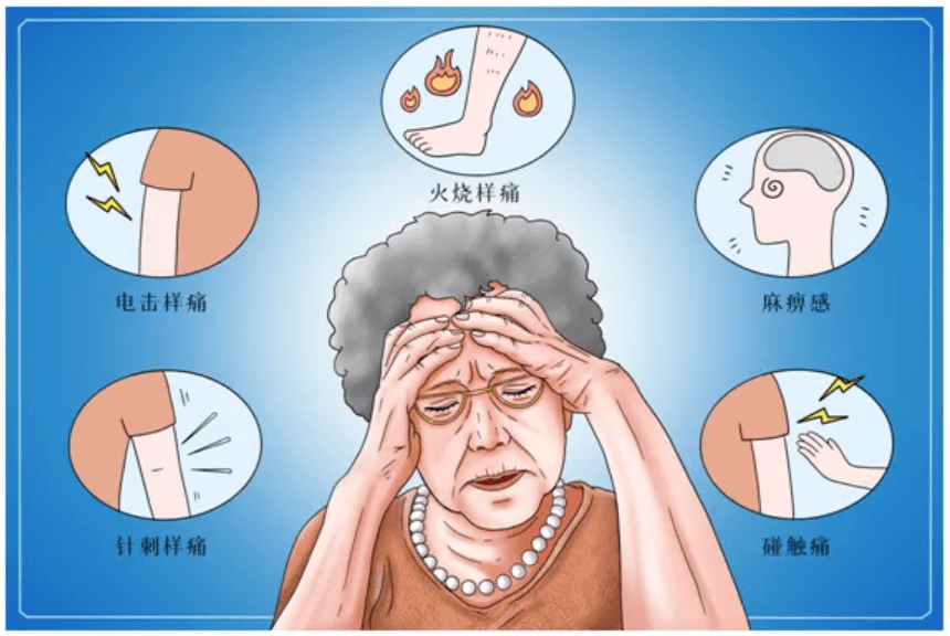 治疗糖尿病周围神经病变的7类药物怎么用?都给你总结好了!_感觉_患者_