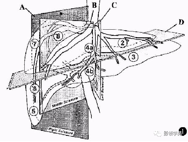 分段具体方法肝段就是以glisson 系统为中心,包括其所属血供和胆汁