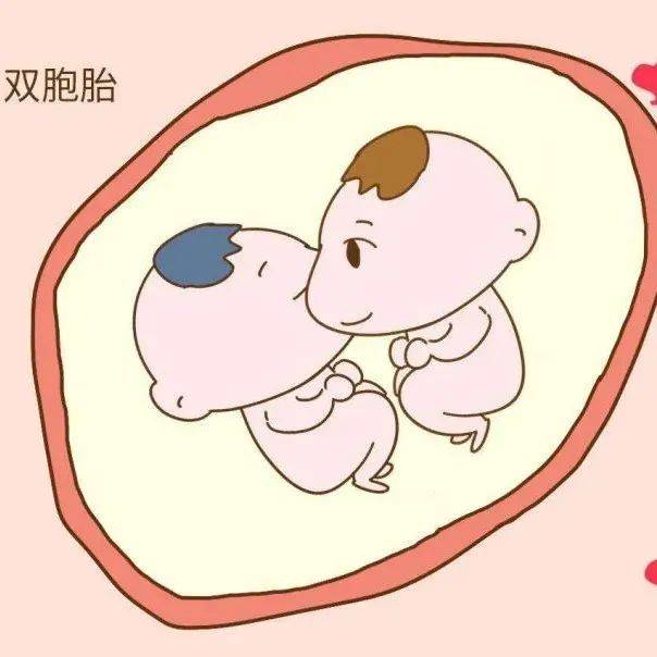 双胎妊娠的“喜和忧”_绒毛_羊膜_胎儿