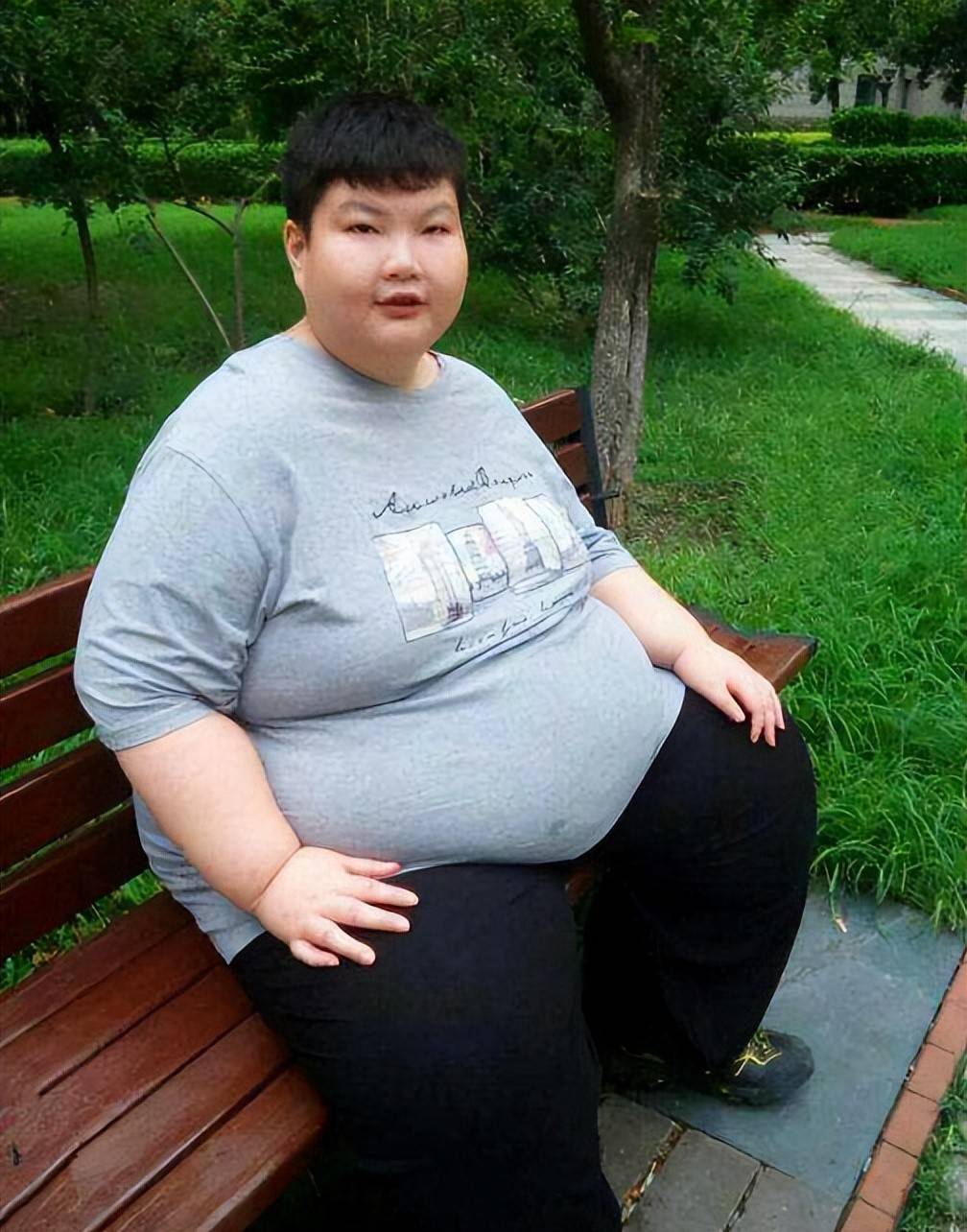 原创食欲真是由基因决定的江西男孩一顿十几碗饭体重暴涨到300斤