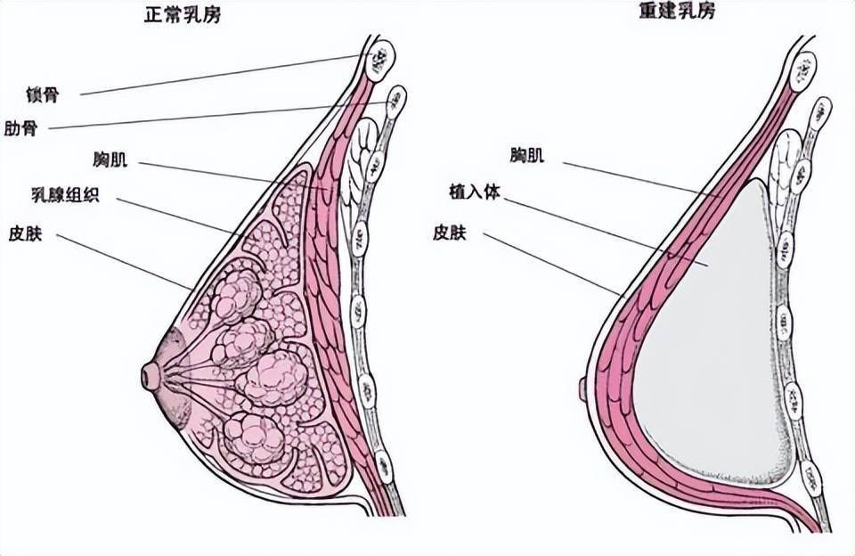 医生详细解答_乳房_检查_乳腺