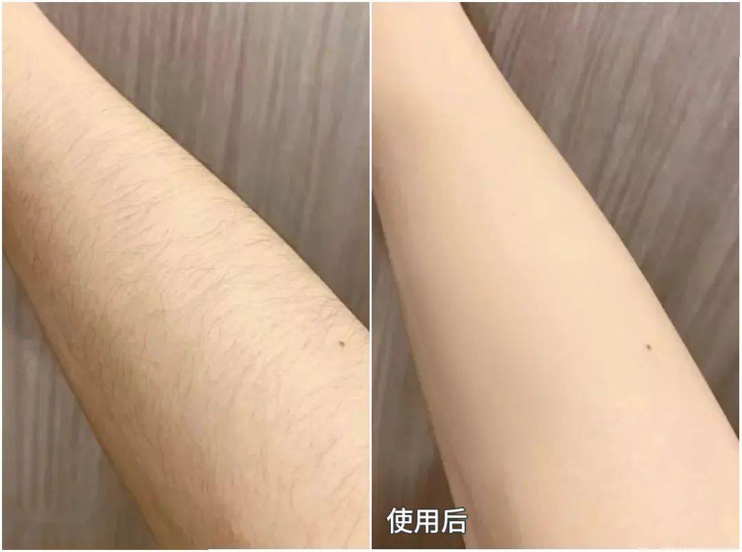 脱毛后多久涂身体乳好呢(脱毛后多久涂身体乳好呢女生) 脱毛后多久涂身体乳好呢(脱毛后多久涂身体乳好呢女生)