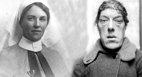 曾被称为世界上最丑的女人但她却有着一颗最美的心