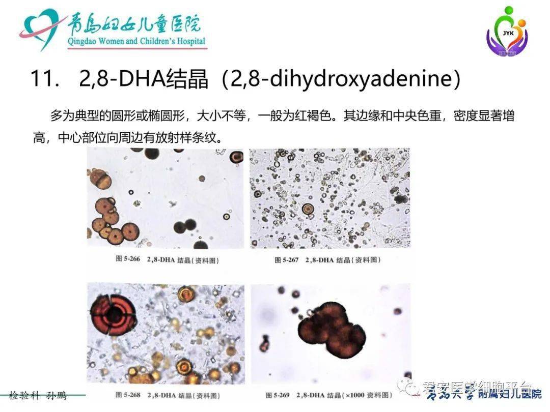 尿液大千世界之药物结晶
