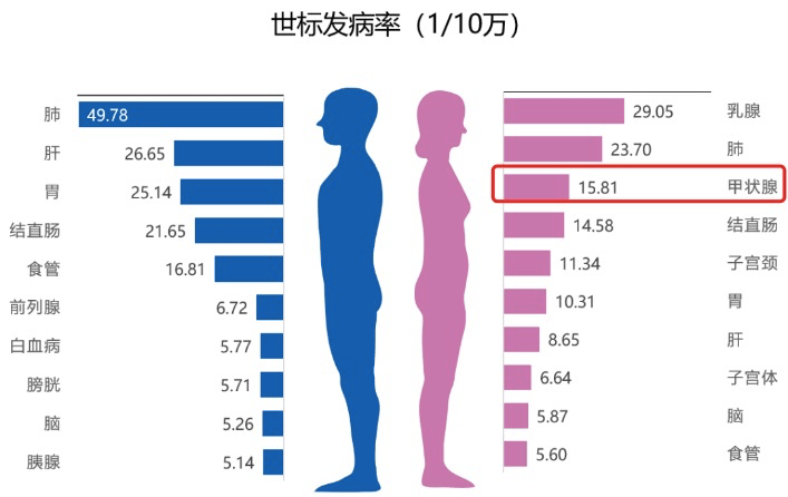 甲狀腺癌發病率飆升20倍問題到底出在哪裡