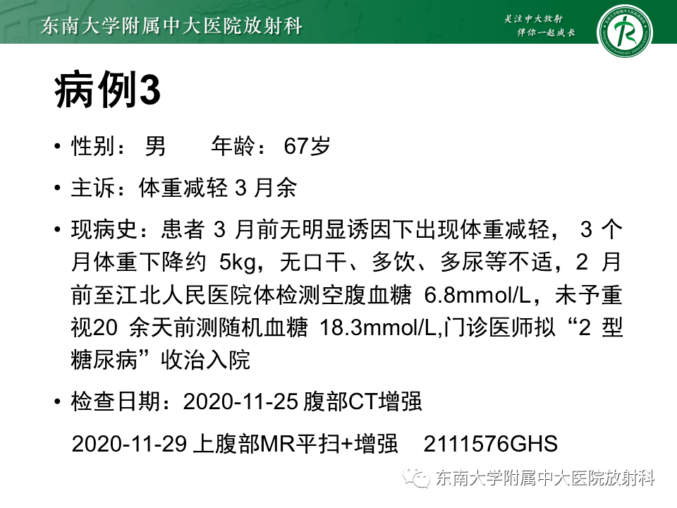 肝臟炎性肌纖維母細胞瘤影像表現_全網_解剖圖_系統