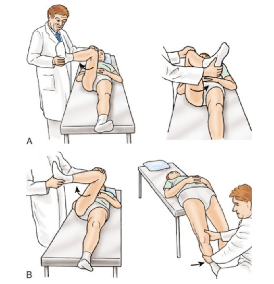 髋关节_股骨_动作