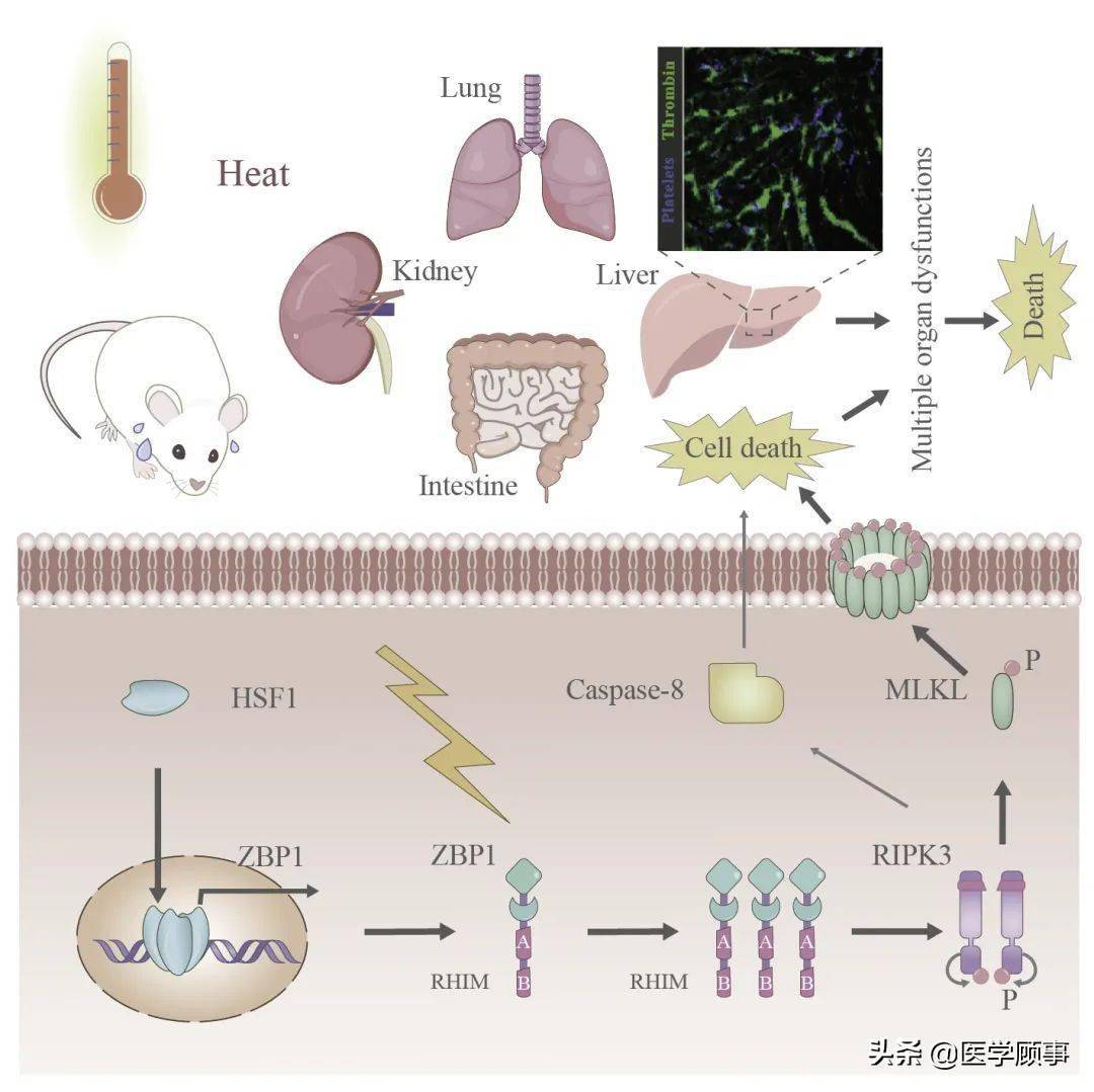 article,題為z-dna binding protein 1 promotes heatstroke-induced