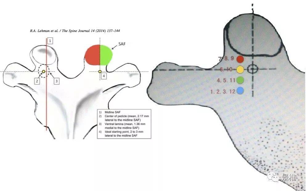 收藏丨胸椎、颈椎、腰椎椎弓根置钉技术