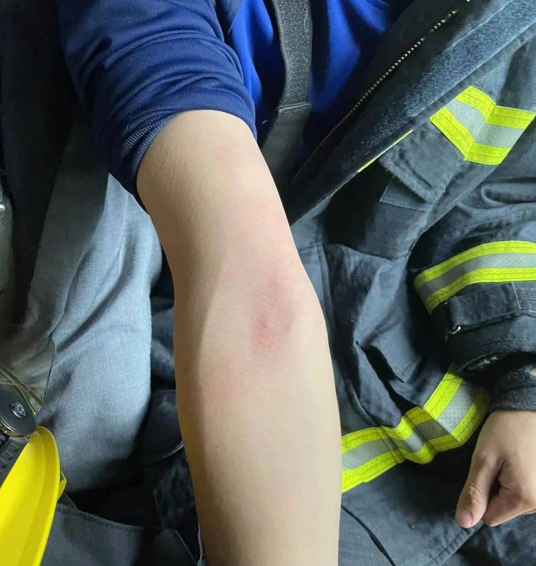 消防战士受伤图片
