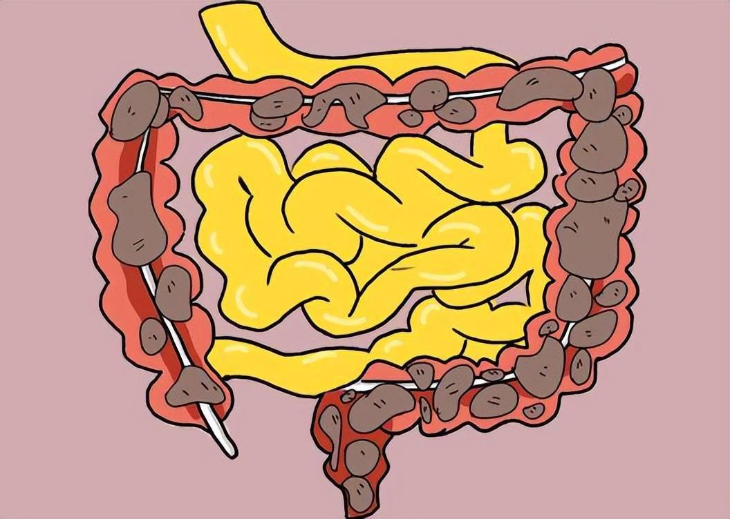 上厕所时大便前头干硬后头软粘说明了什么不妨了解