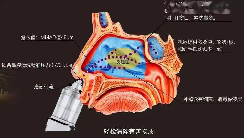 鼻腔内视图图片