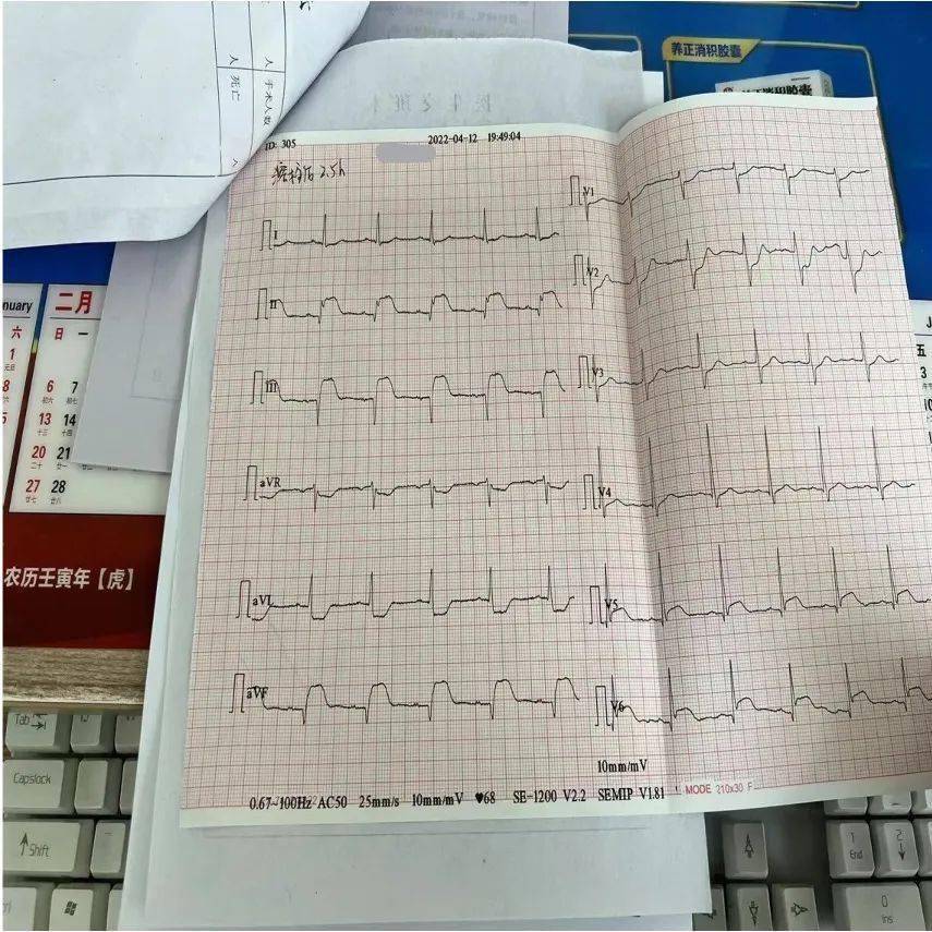 stemi溶栓61经典病例普佑克挽救急性下壁后壁心梗一例