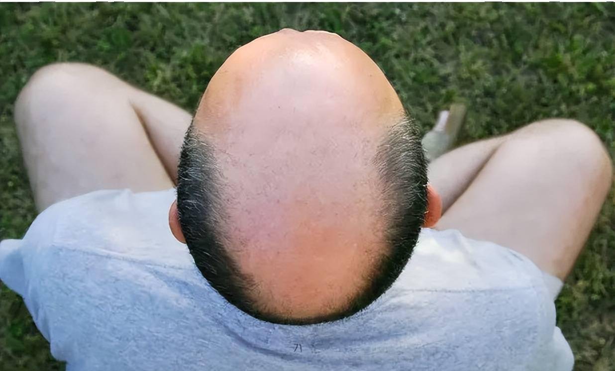 全世界最帅的秃头男人图片
