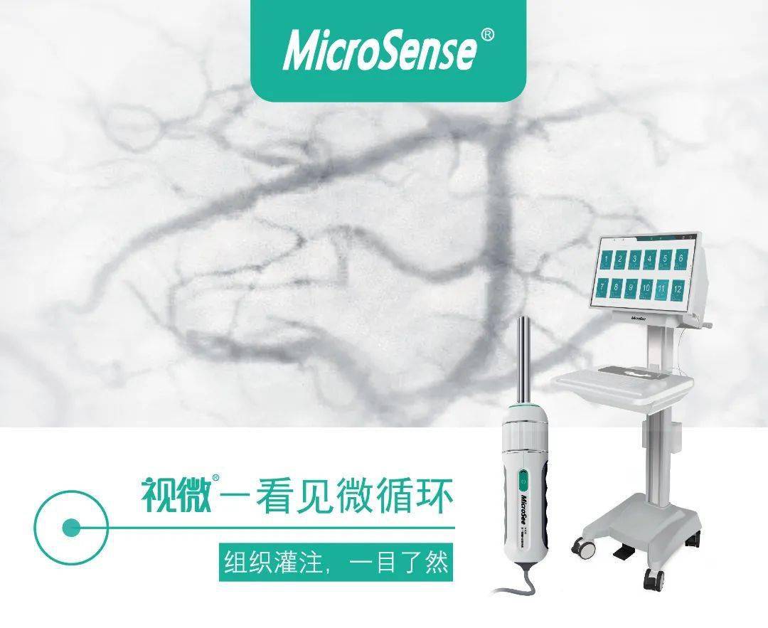 舌下微循环的功能评估可以提示心源性休克患者撤vaecmo成功