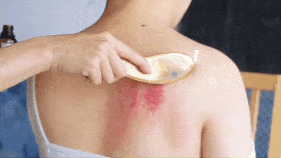 "_刮痧_乳房_位置