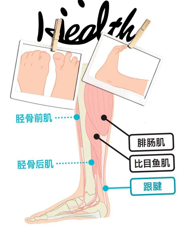 足部专家跟腱拉伸是保持足部年轻的万能药