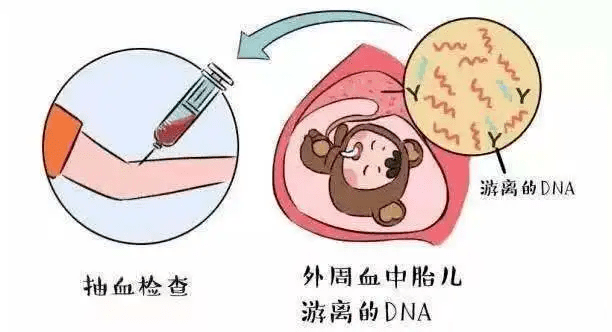 @准妈妈们，这篇无创DNA检测文章，请收好！