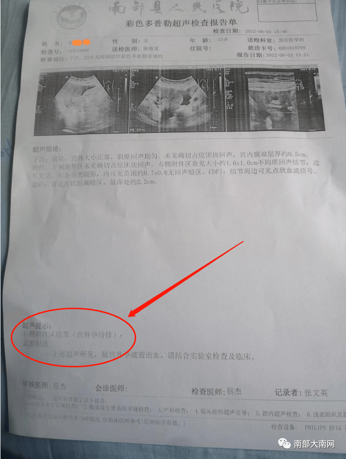 宫外孕诊断书完整图片图片