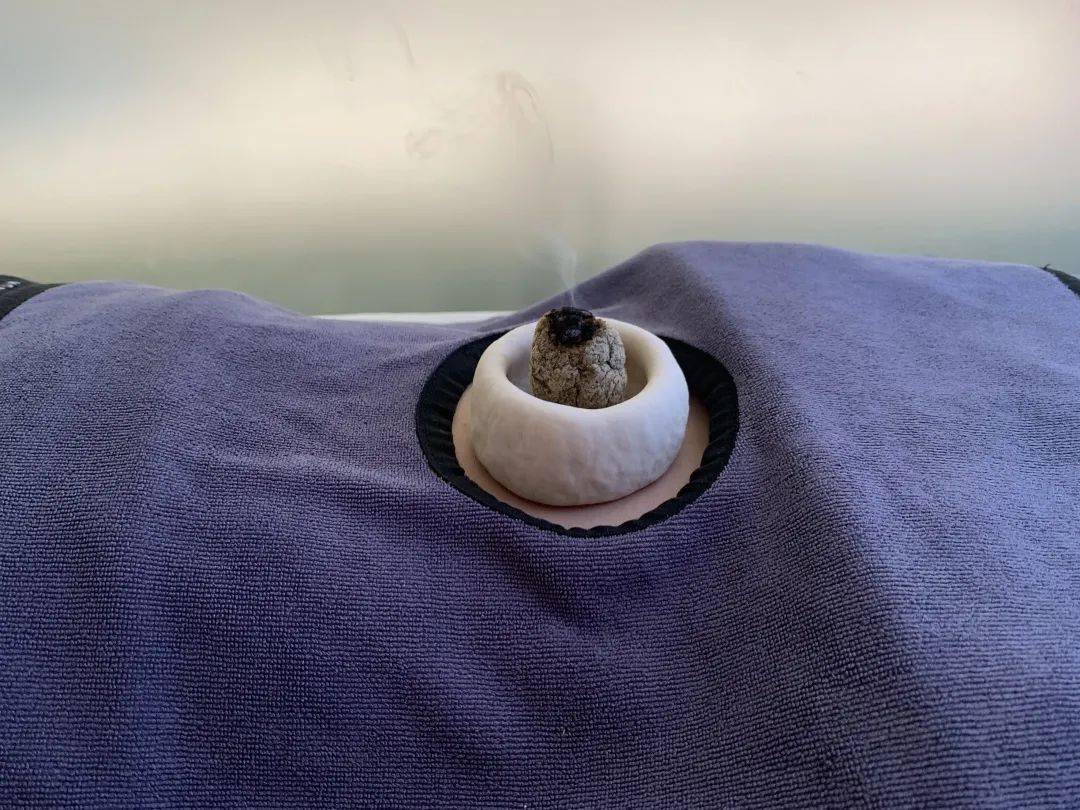 脐灸,即在肚脐上隔药施灸,利用肚脐皮肤薄,敏感度