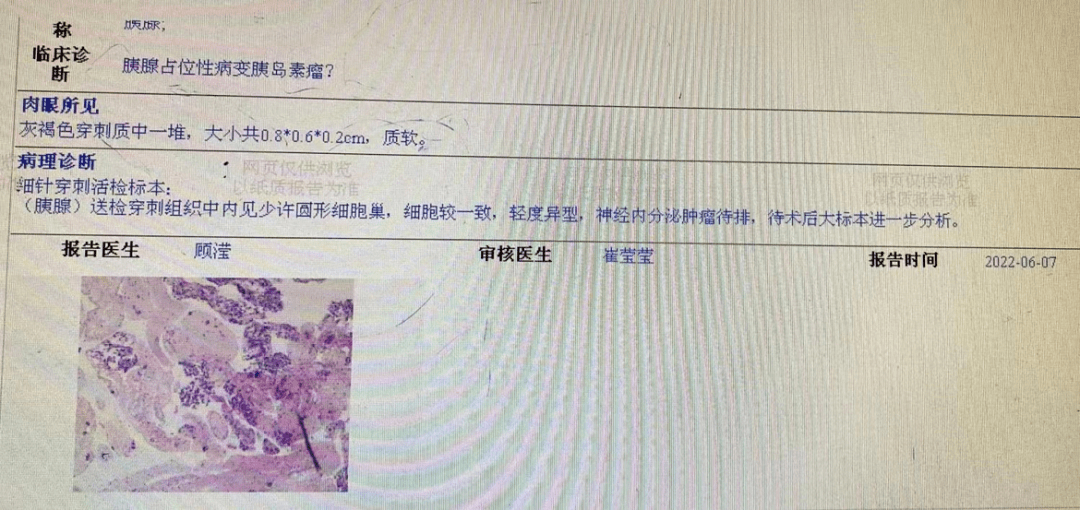 正常胰岛素报告单图片